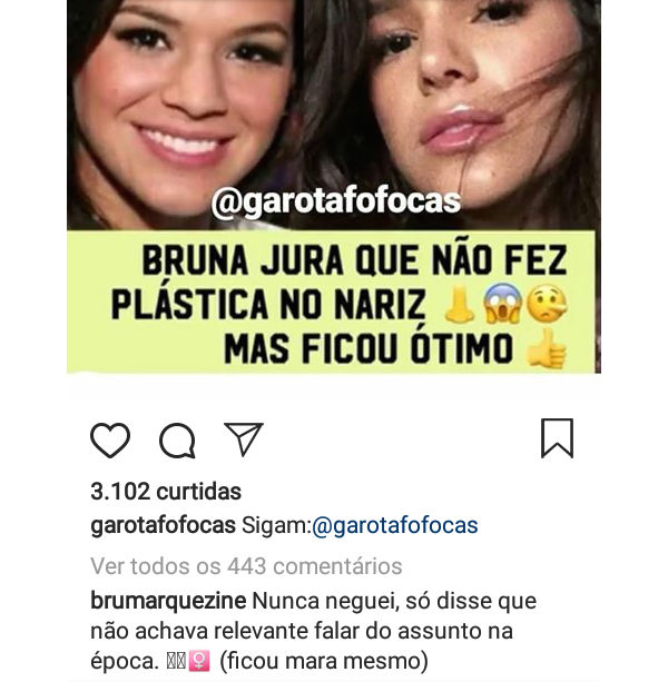 Bruna Marquezine revela que fez cirurgia plástica no nariz (Reprodução)